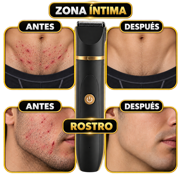 Feature product image