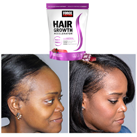 Feature product image